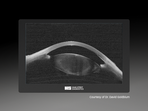 Eyestar 900 - Anterior Chamber Suite